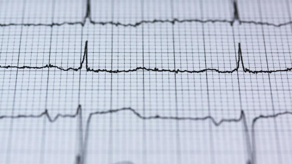 zdjęcie ilustracyjne