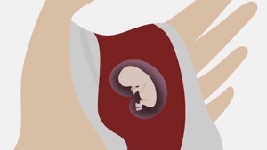 Tak Francja wspiera aborcję. Antykoncepcja i pigułki wczesnoporonne dostępne już dla dzieci. I to bezpłatnie