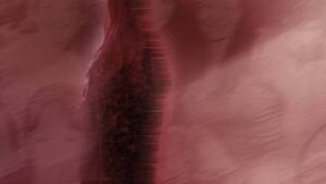 Młoda dziewczyna bardzo cierpi. Potrzebna siła Twojej modlitwy!