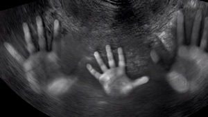 O zakaz aborcji eugenicznej w polskim prawie