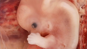 Australia zamówiła miliony szczepionek na koronawirusa, w których są komórki abortowanych dzieci. "To powszechna praktyka". Biskupi protestują