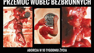 Zawiadomienie do Prokuratury ws. mafii aborcyjnej działającej w Polsce