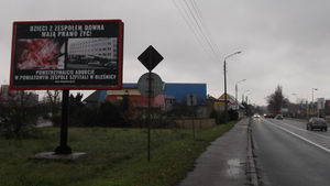 Prawda o zabijanych dzieciach w oczy kole dyrekcję szpitala w Oleśnicy