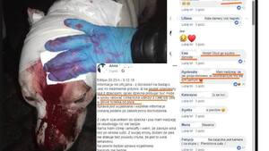 Amstaff pogryzł dziewczynkę, a psiary... zaatakowały  jej ojca na Facebooku za obronę córki