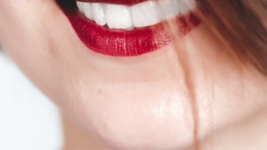 Jakie są zalety implantów dentystycznych?