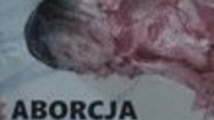 Awantura w sejmowej komisji – większość opozycji chce wymordowania chorych dzieci