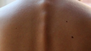 Kinesiotaping - skuteczna metoda walki z bólem