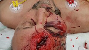 Niemiecki poseł pobity! Lewicowe bojówki w natarciu?