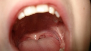 Niestety, jesteśmy szczerbaci, czyli o polskich problemach dentystycznych