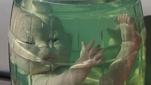 Przepisy dotyczące in vitro nie chronią godności i praw dziecka poczętego