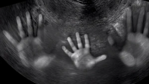 Gendercide: aborcyjne piekło dziewczynek – raport Ordo Iuris