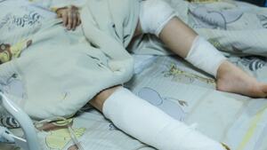 WHO ostrzega przed nową epidemią! Może wybuchnąć na Ukrainie!