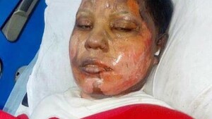 Chrześcijanka nie chciała przejść na islam i wyjść za muzułmanina – oblał ją benzyną i podpalił